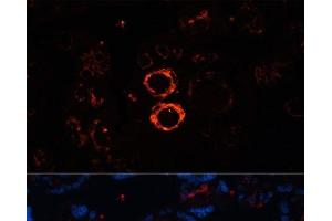 Immunofluorescence analysis of Human placenta cells using MYH11 Polyclonal Antibody at dilution of 1:100. (MYH11 抗体)