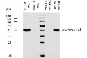 Western blotting analysis of human cytokeratin 18 using mouse monoclonal antibody DC-10 on lysates of HT-29 cell line and MOLT-4 cell line (cytokeratin non-expressing cell line, negative control) under non-reducing and reducing conditions.