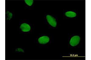 Immunofluorescence of purified MaxPab antibody to CHD2 on HeLa cell. (CHD2 抗体  (AA 1-501))