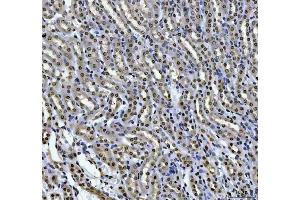IHC analysis of HOXC4 using anti-HOXC4 antibody (ABIN7603059). (HOXC4 抗体  (Middle Region))
