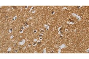 Immunohistochemistry of paraffin-embedded Human brain tissue using KIF4A Polyclonal Antibody at dilution 1:40 (KIF4A 抗体)