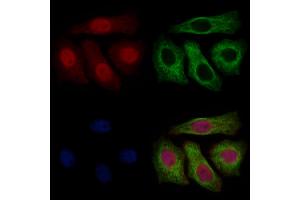 ABIN7094791 and ABIN7098842 staining Hela cells by IF/ICC. (UBA1 抗体  (Internal Region))
