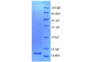 MPZ (AA 30-153) protein (His tag) (MPZ Protein (AA 30-153) (His tag))