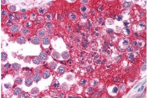 Human Testis (formalin-fixed, paraffin-embedded) stained with FOXE3 antibody ABIN214754 at 5 ug/ml followed by biotinylated goat anti-rabbit IgG secondary antibody ABIN481713, alkaline phosphatase-streptavidin and chromogen. (FOXE3 抗体  (AA 235-284))
