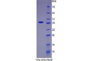SDS-PAGE of Protein Standard from the Kit (Highly purified E. (CRP ELISA 试剂盒)
