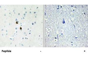 Immunohistochemistry analysis of paraffin-embedded human brain tissue, using PKIA polyclonal antibody .