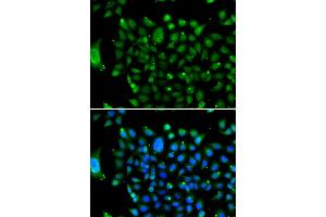Immunofluorescence analysis of U2OS cells using NCOR1 antibody (ABIN5974239). (NCOR1 抗体)