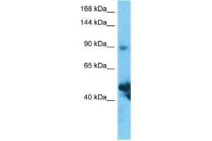 Host:  Rabbit  Target Name:  SLC39A10  Sample Type:  Thymus Tumor lysates  Antibody Dilution:  1. (SLC39A10 抗体  (N-Term))