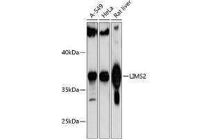 Western blot analysis of extracts of various cell lines, using LIMS2 antibody (ABIN6132166, ABIN6143236, ABIN6143237 and ABIN6217146) at 1:1000 dilution. (LIMS2 抗体  (AA 1-341))