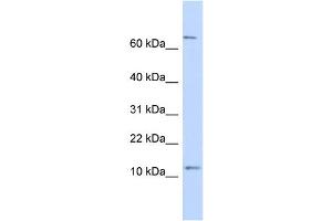 WB Suggested Anti-TRA16 Antibody Titration: 0. (NR2C2AP 抗体  (N-Term))