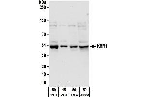 anti-KRR1, Small Subunit (SSU) Processome Component, Homolog (KRR1) (AA 300-350) antibody