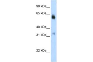 Western Blotting (WB) image for anti-Lysine (K)-Specific Demethylase 4D (KDM4D) antibody (ABIN2461887) (JMJD2D 抗体)