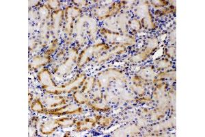 IHC analysis of AMFR using anti-AMFR antibody (ABIN4886455).