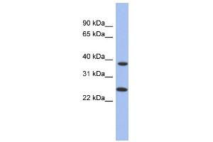 WB Suggested Anti-MTRF1L Antibody Titration: 0. (MTRF1L 抗体  (N-Term))