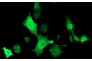 Anti-TMOD1 mouse monoclonal antibody (ABIN2454778) immunofluorescent staining of COS7 cells transiently transfected by pCMV6-ENTRY TMOD1 (RC201134). (Tropomodulin 1 抗体)