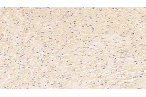 Immunohistochemistry (IHC) image for anti-Myogenin (Myogenic Factor 4) (MYOG) (AA 4-219) antibody (ABIN7442843)