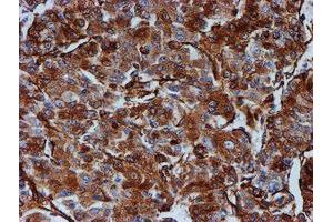 Immunohistochemistry (IHC) image for anti-Tubulin beta 4a (TUBB4A) antibody (ABIN1501579) (TUBB4 抗体)