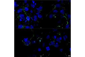 Immunocytochemistry/Immunofluorescence analysis using Mouse Anti-LRP4 Monoclonal Antibody, Clone S207-27 (ABIN2483391). (LRP4 抗体  (AA 26-350) (PE))