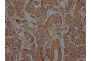 Immunohistochemistry (IHC) image for anti-Protein tyrosine Phosphatase, Non-Receptor Type 1 (PTPN1) antibody (ABIN7127784)