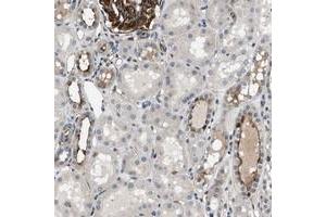Immunohistochemical staining of human kidney with GPRC5B polyclonal antibody  shows membranous positivity in glomeruli at 1:50-1:200 dilution.
