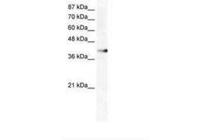 Image no. 1 for anti-Zinc Finger Protein 556 (ZNF556) (AA 322-371) antibody (ABIN202562) (ZNF556 抗体  (AA 322-371))