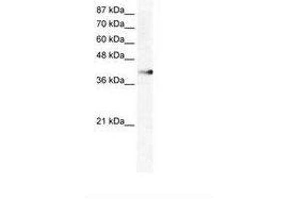 ZNF556 anticorps  (AA 322-371)