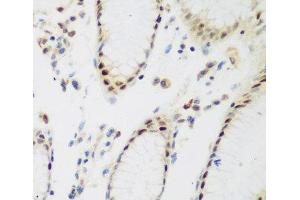 Immunohistochemistry of paraffin-embedded Human stomach using PPAN Polyclonal Antibody at dilution of 1:200 (40x lens). (PPAN 抗体)