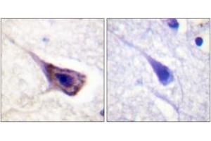 Immunohistochemistry analysis of paraffin-embedded human brain tissue, using BAD (Ab-134) Antibody. (BAD 抗体  (AA 100-149))