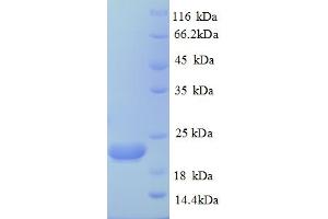 Caspase 8 (CASP8) (AA 217-479) protein (His tag)
