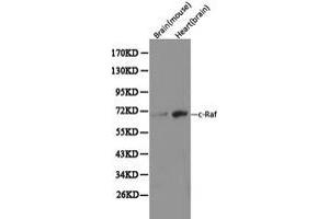 Western Blotting (WB) image for anti-V-Raf-1 Murine Leukemia Viral Oncogene Homolog 1 (RAF1) (C-Term) antibody (ABIN1874535) (RAF1 抗体  (C-Term))