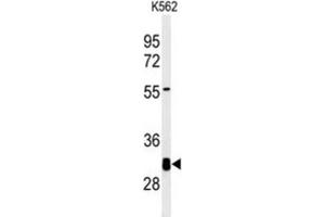 Western Blotting (WB) image for anti-Potassium Channel Tetramerisation Domain Containing 7 (KCTD7) antibody (ABIN3002217) (KCTD7 抗体)