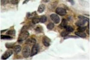 Image no. 2 for anti-Nuclear Factor of kappa Light Polypeptide Gene Enhancer in B-Cells Inhibitor, alpha (NFKBIA) (pSer32), (pSer36) antibody (ABIN318052) (NFKBIA 抗体  (pSer32, pSer36))