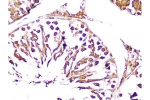 Immunohistochemistry of paraffin-embedded rat testis using UCHL3 Rabbit mAb (ABIN1682628, ABIN3015461, ABIN3015462 and ABIN7101429) at dilution of 1:100 (40x lens). (UCHL3 抗体)
