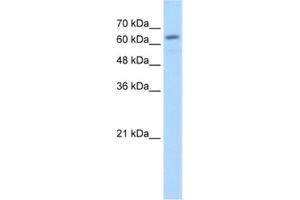 Western Blotting (WB) image for anti-Glucuronidase, beta (GUSB) antibody (ABIN2462794) (Glucuronidase beta 抗体)