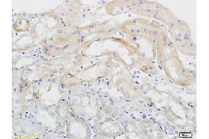 Formalin-fixed and paraffin embedded rat kidney labeled with Anti Endomucin Polyclonal Antibody, Unconjugated (ABIN1385912) at 1:200 followed by conjugation to the secondary antibody and DAB staining (Endomucin 抗体  (AA 21-120))