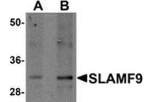 Western blot analysis of SLAMF9 in mouse kidney tissue lysate with SLAMF9 antibody at (A) 1 and (B) 2 μg/ml. (SLAMF9 抗体  (C-Term))