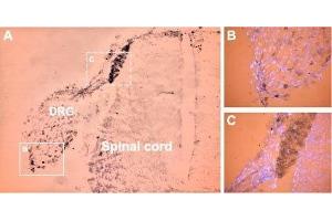 Expression of NaV1. (SCN11A 抗体  (Intracellular))