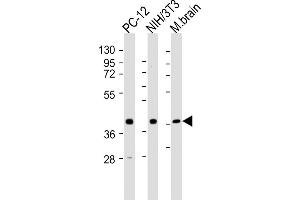 All lanes : Anti-Rnf2 Antibody (Center) at 1:2000 dilution Lane 1: PC-12 whole cell lysates Lane 2: NIH/3T3 whole cell lysates Lane 3: mouse brain lysates Lysates/proteins at 20 μg per lane. (RNF2 抗体  (AA 198-232))