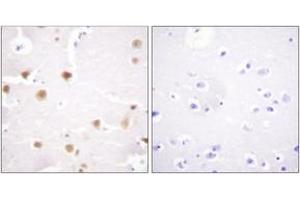 Immunohistochemistry (IHC) image for anti-Jun Proto-Oncogene (JUN) (AA 221-270) antibody (ABIN2888807) (C-JUN 抗体  (AA 221-270))