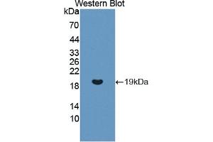 Detection of Recombinant REG3g, Human using Polyclonal Antibody to Regenerating Islet Derived Protein 3 Gamma (REG3g)