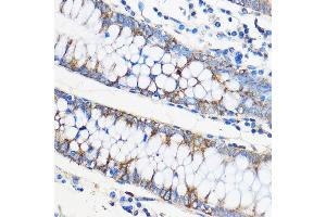 Immunohistochemistry of paraffin-embedded Human colon using ApoM Rabbit pAb (ABIN6127365, ABIN6137030, ABIN6137031 and ABIN6220968) at dilution of 1:50 (40x lens).