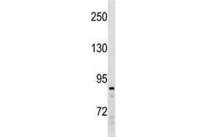 SUZ12 antibody western blot analysis in Ramos lysate. (SUZ12 抗体  (AA 559-588))