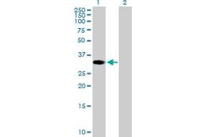 Western Blot analysis of ZNF101 expression in transfected 293T cell line by ZNF101 MaxPab polyclonal antibody. (ZNF101 抗体  (AA 1-316))