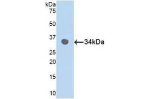 Detection of Recombinant MAPK9, Human using Polyclonal Antibody to Mitogen Activated Protein Kinase 9 (MAPK9) (JNK2 抗体  (AA 130-387))