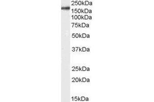 Western Blotting (WB) image for Integrin alpha M (ITGAM) peptide (ABIN369797)
