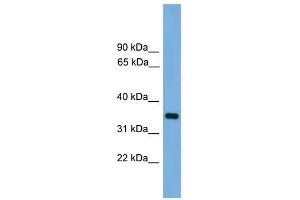 PRSS3 antibody used at 1 ug/ml to detect target protein. (PRSS3 抗体  (N-Term))