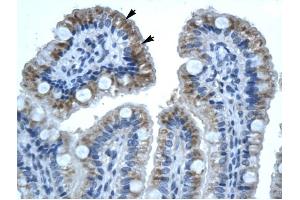 GJB1 antibody was used for immunohistochemistry at a concentration of 4-8 ug/ml to stain Epithelial cells of intestinal villus (lndicated with Arrows) in Human Intestine. (GJB1 抗体  (C-Term))
