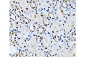 Immunohistochemistry of paraffin-embedded Rat kidney using CCAR2 Polyclonal Antibody at dilution of 1:100 (40x lens). (CCAR2 抗体)