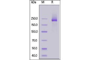 Mouse LY75, His Tag on  under reducing (R) condition. (LY75/DEC-205 Protein (AA 28-1667) (His tag))