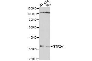 Western blot analysis of extracts of various cell lines, using GTF2A1 antibody (ABIN1876533) at 1:1000 dilution. (GTF2A1 抗体)